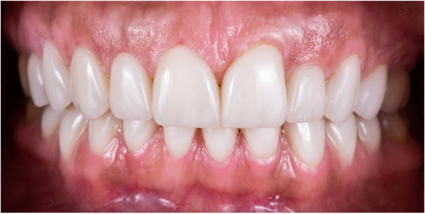 Smile before cosmetic dental treatment